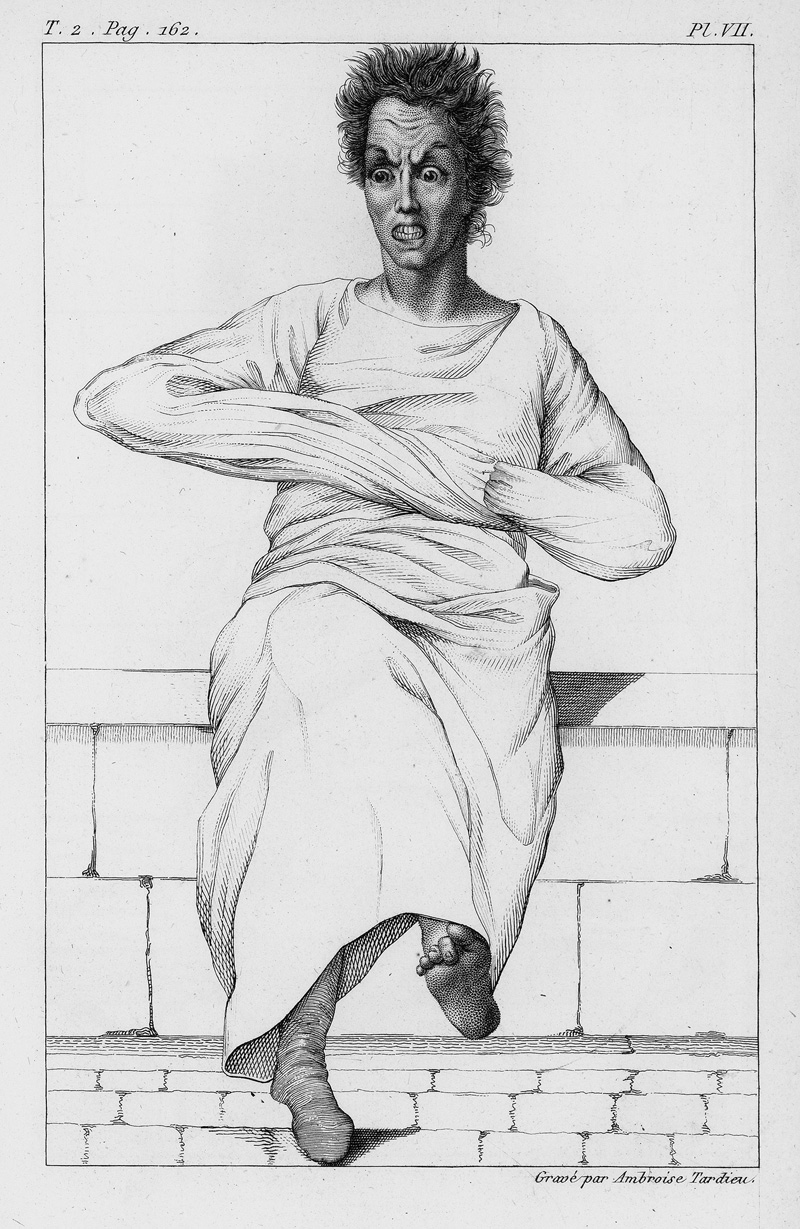 Lot 312, Auction  125, Esquirol, Jean Étienne und Tardieu, Ambroise, Des maladies mentales. Considérées sous les rapport médical, hygiénique et médico-légal. Paris, Jean-Baptiste Baillière, 1838. - Erste Ausgabe des grundlegenden Werkes zur Klassifikation und Behandlung von psychischen Krankheiten