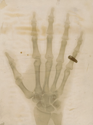 Lot 4247, Auction  126, X-ray Photography, X-ray of a hand with a ring