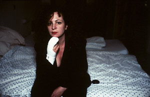 Los 4176 - Goldin, Nan - Self-portrait after finger operation, Berlin - 0 - thumb